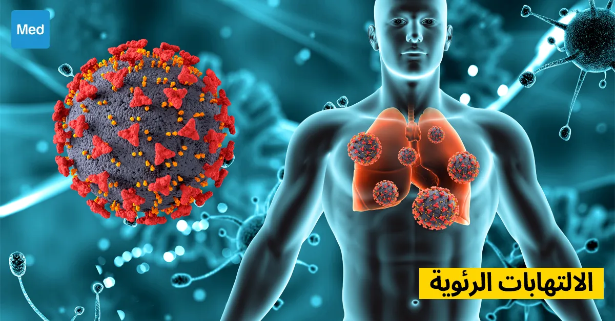 الالتهابات الرئوية